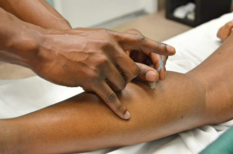 acupuncturist